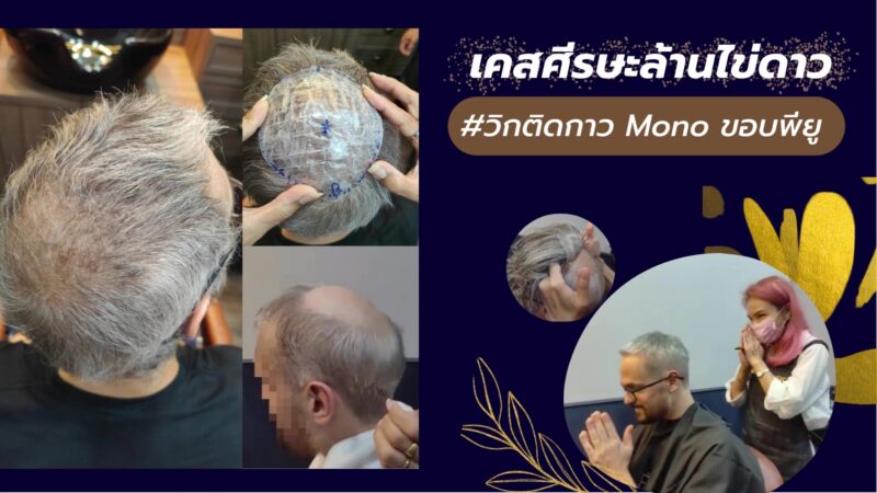 วิกผมแท้ วิกติดกาวผู้ชาย Yumiko Wig Studio