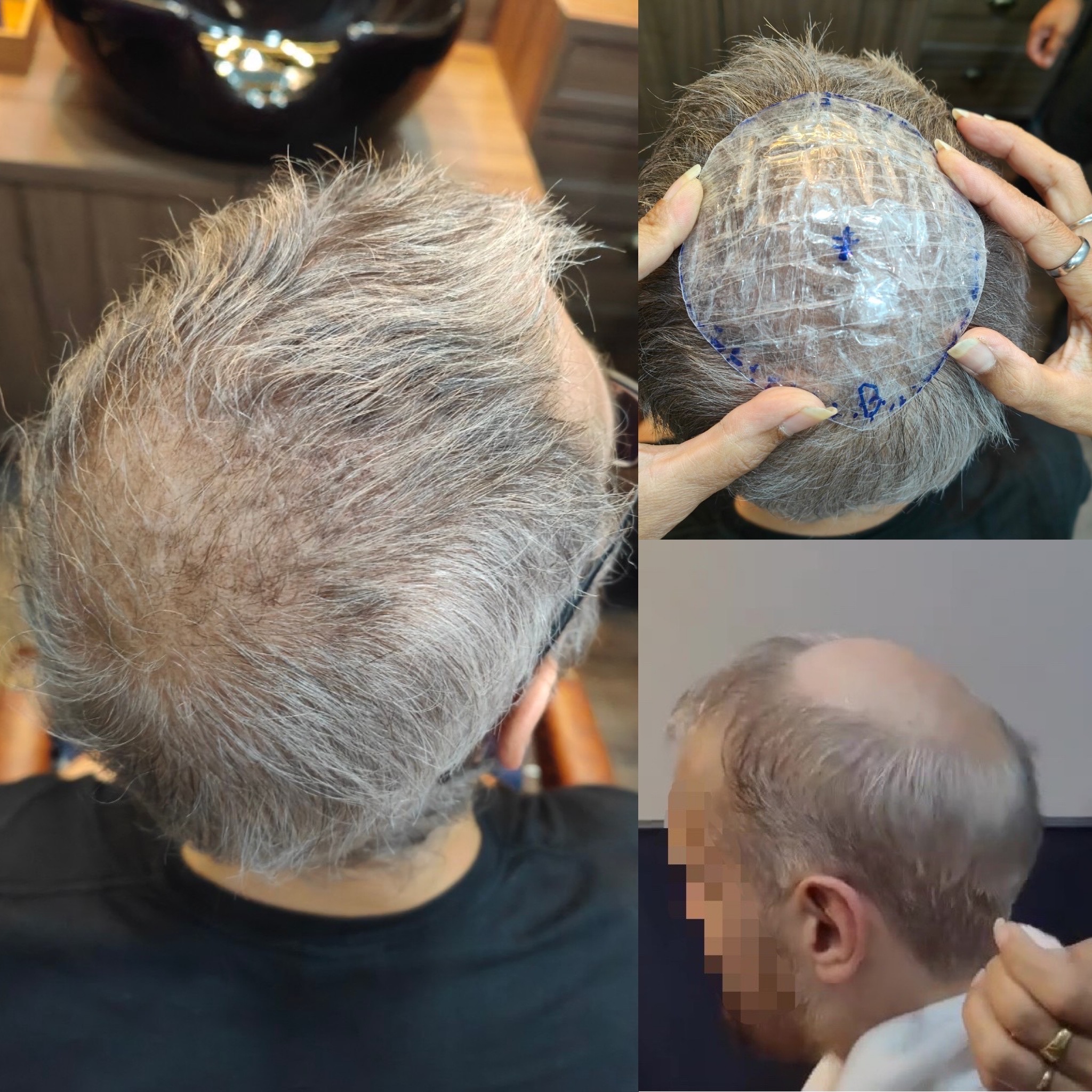 รีวิว วิกผมแท้ วิกติดกาวผู้ชาย ศีรษะล้านไข่ดาว Yumiko Wig Studio_04
