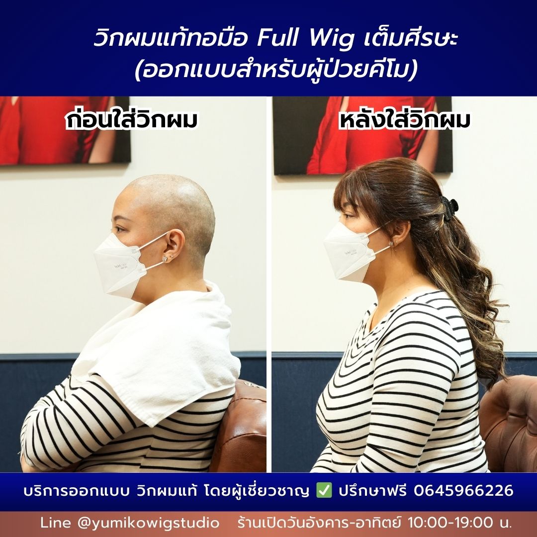 รีวิว วิกผมแท้ ผู้ป่วยมะเร็ง Before-After Yumiko Wig Studio