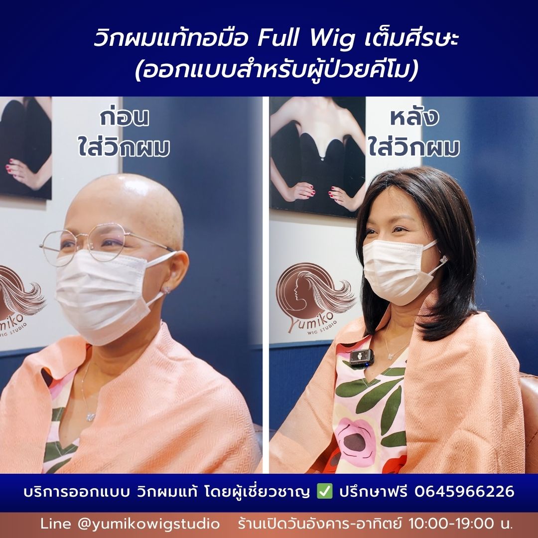 รีวิว วิกผมแท้ ผู้ป่วยมะเร็ง Before-After วิกผมแท้ทอมือ Yumiko Wig Studio