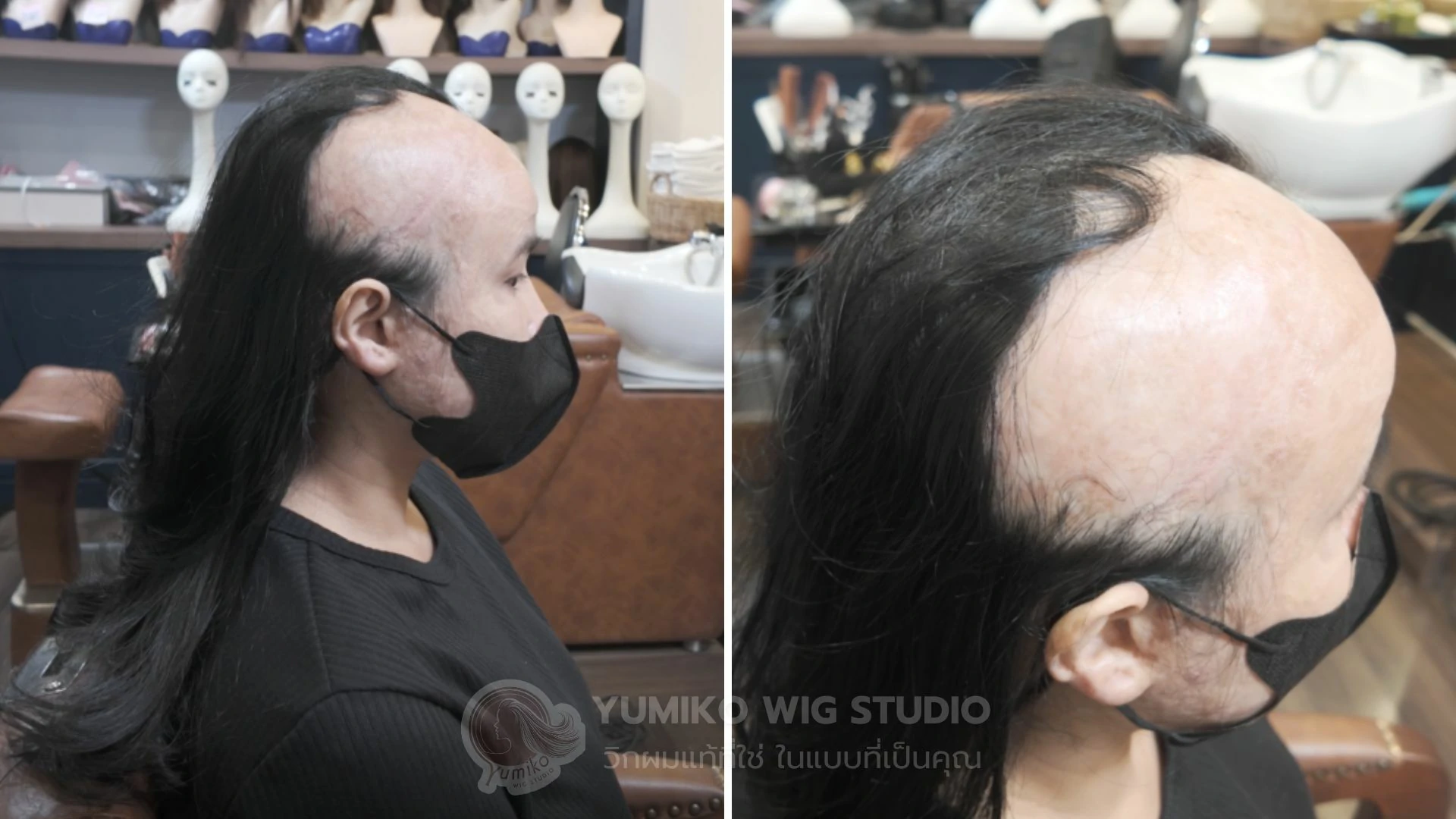 รีวิว มั่นใจขึ้นทุกวันด้วย วิกผมแท้ Yumiko Wig Studio (Before)