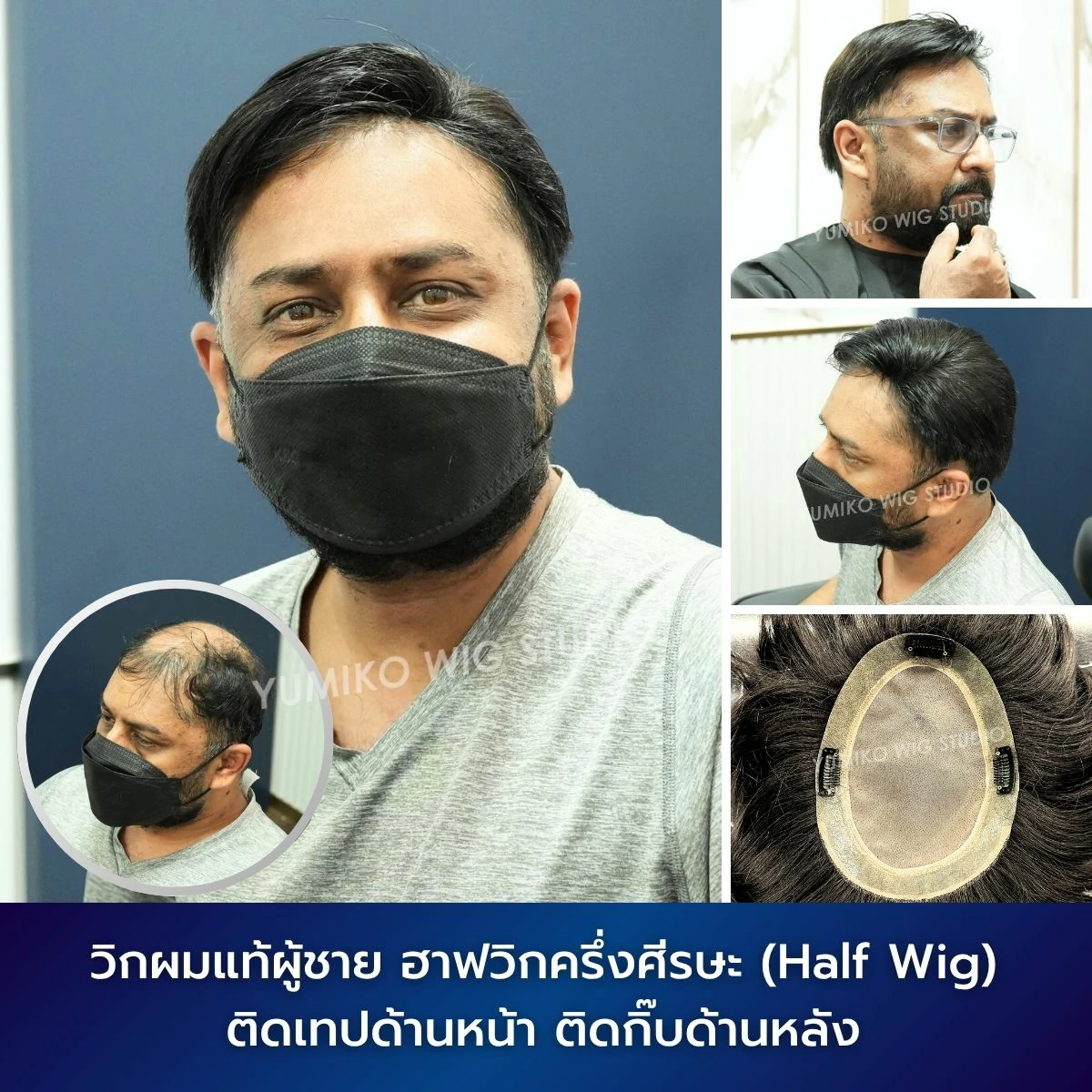 รีวิว วิกผมแท้ ผู้ชาย ผมบาง ฮาฟวิก ครึ่งศีรษะ วิกผม ติดเทปด้านหน้า ติดกิ๊บด้านหลัง Yumiko Wig Studio_1