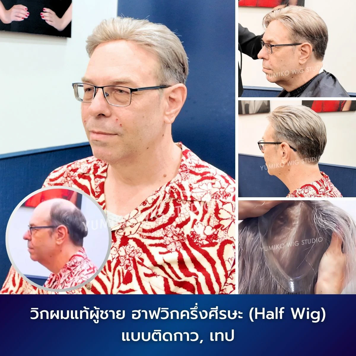รีวิว วิกผมแท้ ผู้ชาย ผมบาง ฮาฟวิก ครึ่งศีรษะ วิกผม วิกติดกาว ติดเทป Yumiko Wig Studio_5