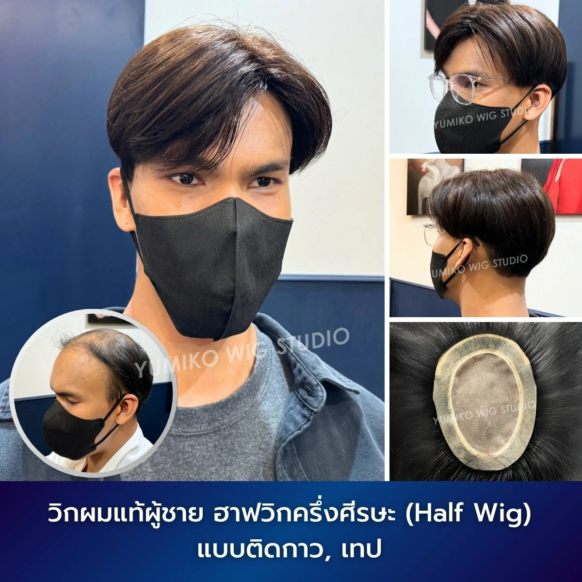 รีวิว วิกผมแท้ ผู้ชาย ผมบาง ฮาฟวิก ครึ่งศีรษะ วิกผม วิกติดกาว ติดเทป Yumiko Wig Studio_6