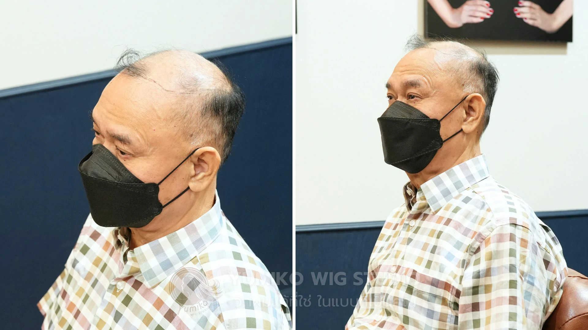 รีวิว ก่อนใส่วิกผมแท้ Yumiko Wig Studio