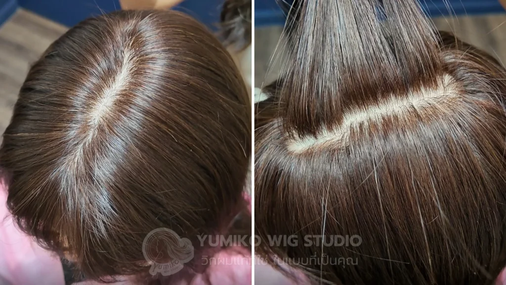 รีวิว วิกผมแท้ ผู้หญิง เต็มศีรษะ Full Wig ติดเทป ใส่เล่นน้ำได้ Yumiko Wig Studio-4