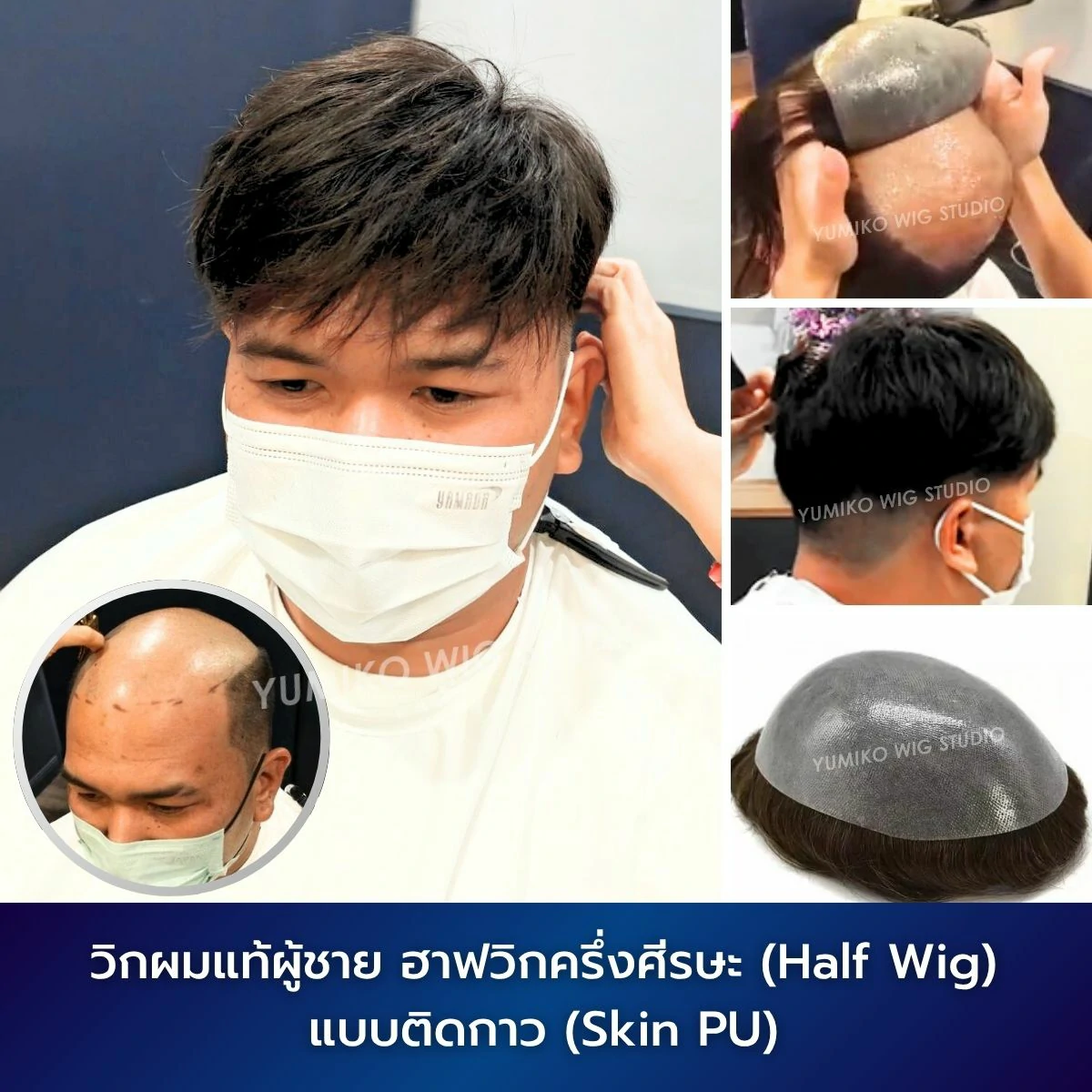 วิกผมแท้ Yumiko วิกติดกาว Skin PU วิกผมสั้น ผู้ชาย Yumiko Wig Studio