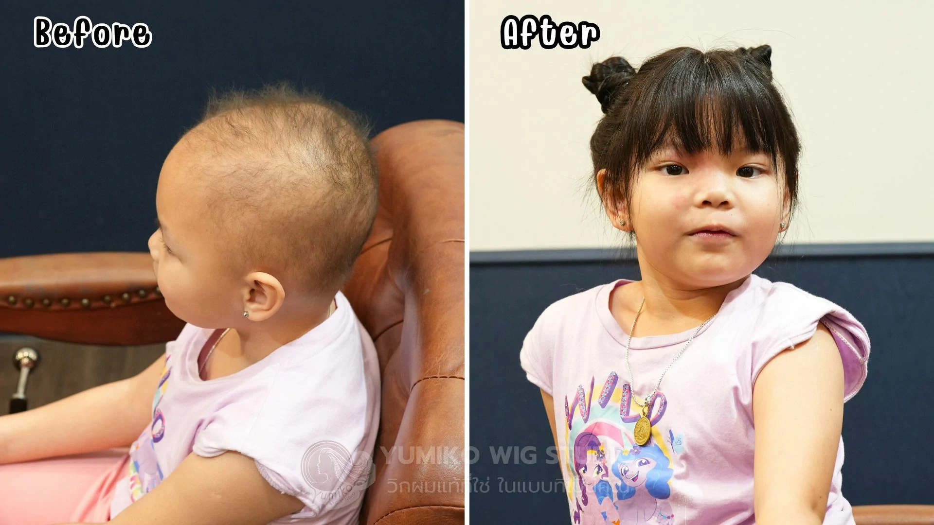 รีวิว วิกผมแท้ Yumiko รอยยิ้มนี้คือพลังใจที่ยิ่งใหญ่ของพวกเรา