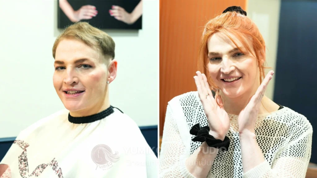 รีวิว วิกผมแท้ Yumiko สิกผมทอมือ ออกแบบเฉพาะบุคคล before-after