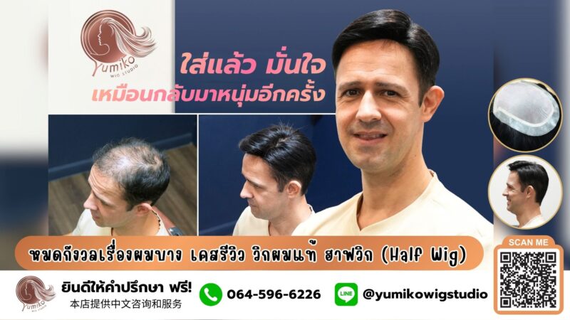 หมดยังวลเรื่องผมบาง รีวิว วิกผมแท้ Yumiko วิกผมผู้ชาย ออกแบบได้ในสไตล์คุณ