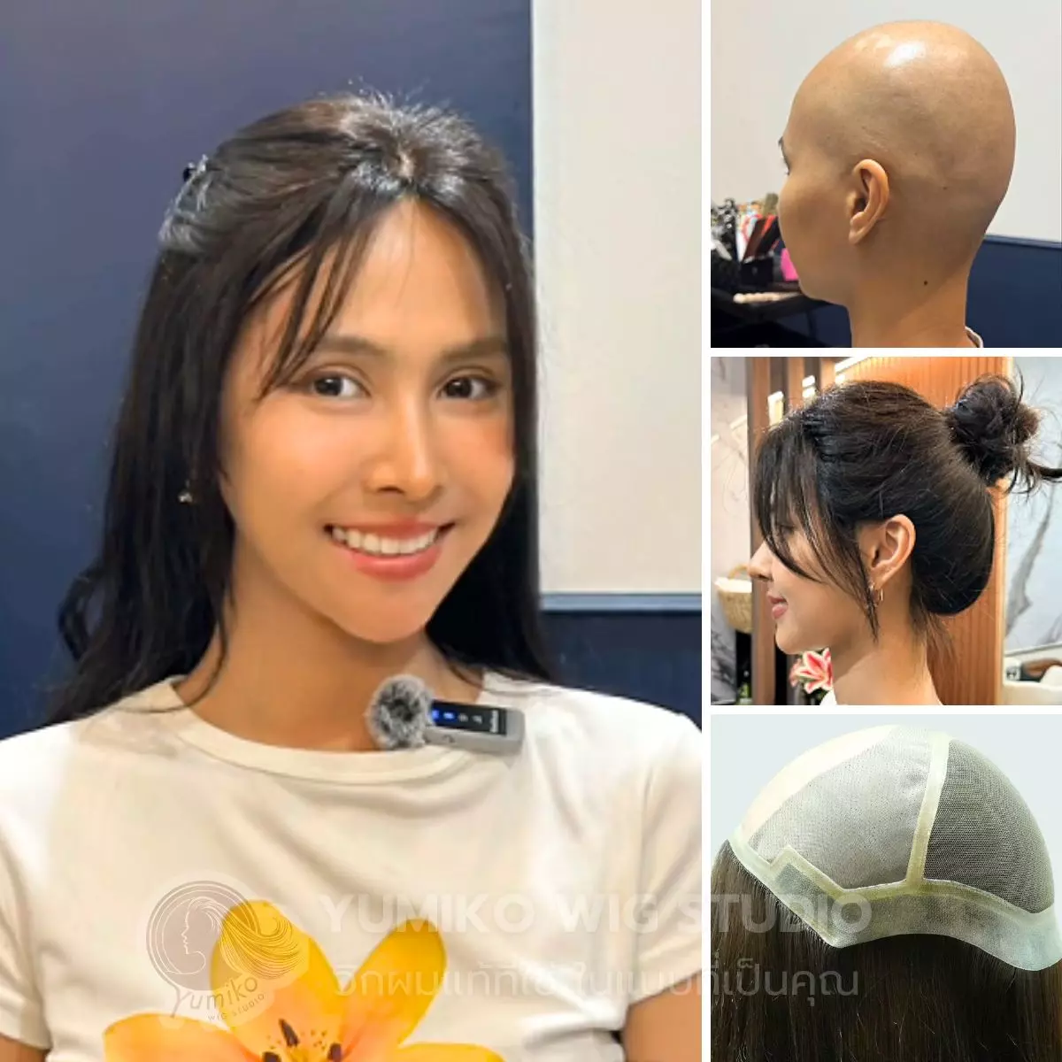 รีีวิว วิกผมผู้ป่วยคีโม วิกผมแท้ Yumiko Wig Studio